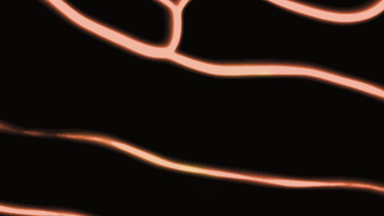 slime: vein-like trails